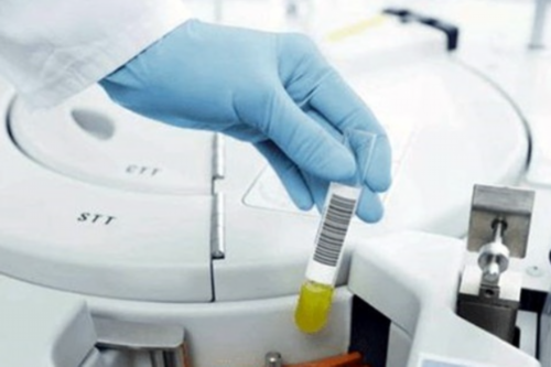 试管捐卵流程:试管婴儿取卵后，教你怎样保护卵巢？