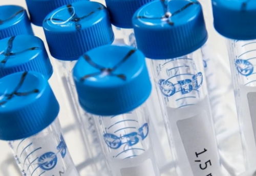 盆腔脏器脱垂如何预防