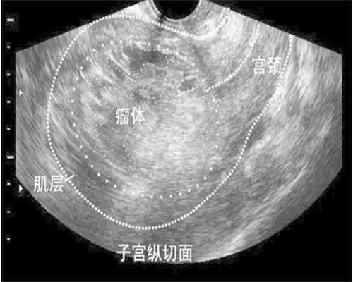 供卵公司-南京做试管婴儿要多少钱？内附2026祖新价格表！