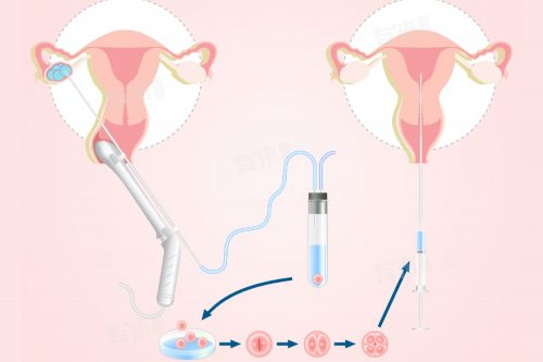 怎样缓解产后子宫收缩疼痛