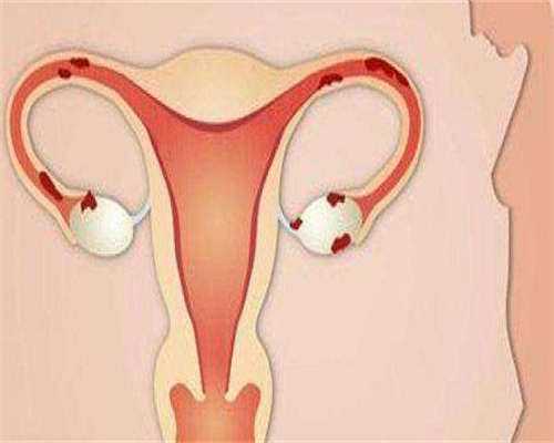 人工授精如何计算孕期,人工授精算怀孕日期从哪天算