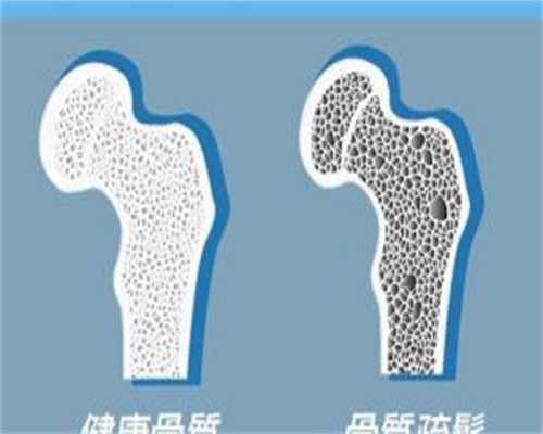 代孕套餐优惠-双胎妊娠的类型分为双卵双胎和单卵双胎两类吗?