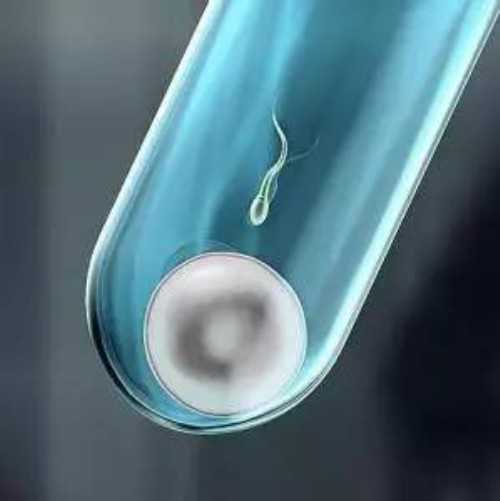 13周做nt正常值范围是不高于3mm吗？