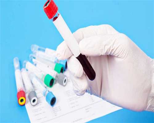 孕期tsh偏高是甲减吗