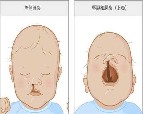 代孕医院最好-囊胚6bc算是什么等级，移植成功率有多少？