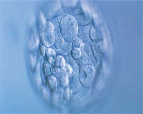 早期唐筛检查不用空腹也能做基本流程主要分三步