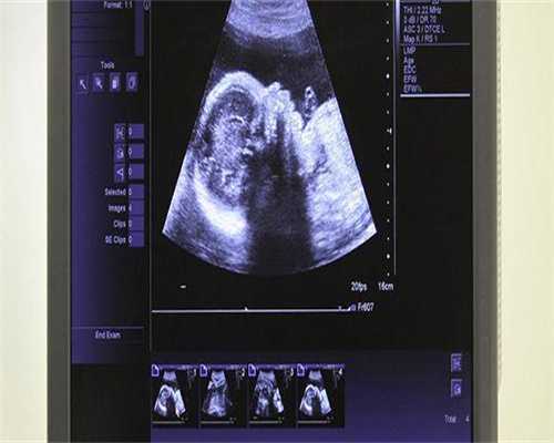 包代生孩子-监测排卵有优势卵泡排出