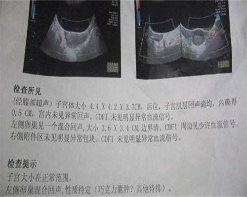 移植后第六天着床了吗