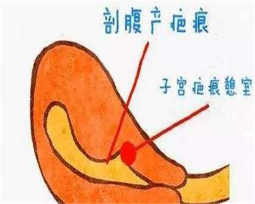 助孕捐卵机构-备孕的时候可以吃感冒药吗(备孕食谱)