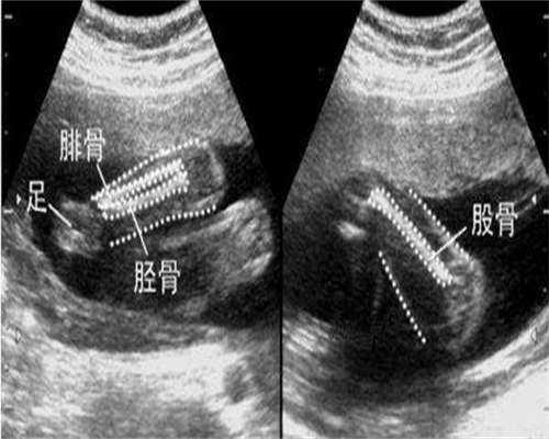 屁股长红疙瘩很痒是什么原因?一文带你了解原因