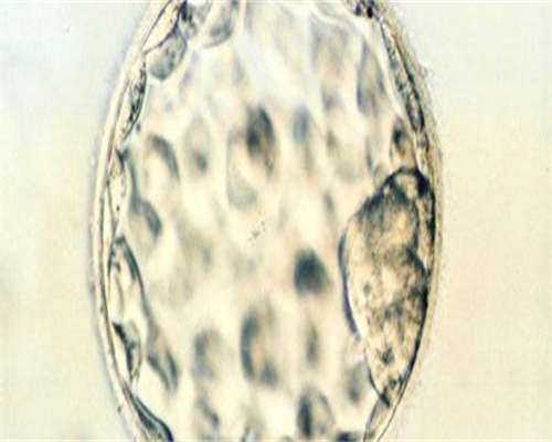 不孕症的常见检查及诊断流程:全面了解不孕症的诊断方法和步骤