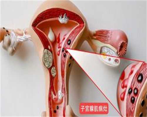 试管移植2个囊胚成功率,试管移植2个囊胚成功率高吗