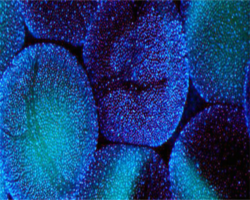 子宫粘连的症状是什么？如何治疗子宫粘连？试管婴儿可以做子宫粘连吗？