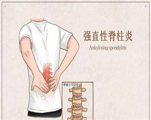 生男孩子代怀-试管婴儿移植后可以坐吗，试管婴儿移植后可以坐但不宜久坐？