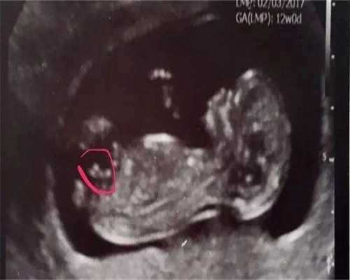 助孕生殖公司-试管移植后几天能用试纸测出怀孕