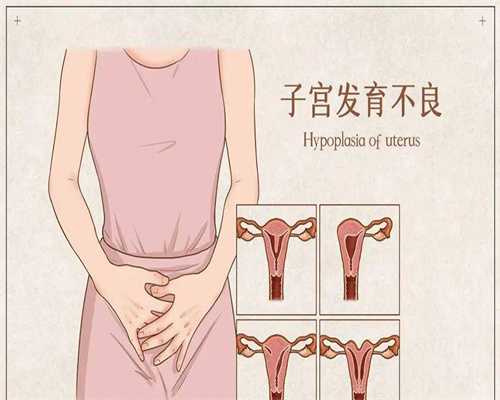 试管代生女孩-女性单侧巧克力囊肿5cm自然怀孕的几率大不大？