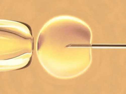 助孕咨询联系:子宫肌瘤会引起腰酸吗子宫肌瘤有哪些症状