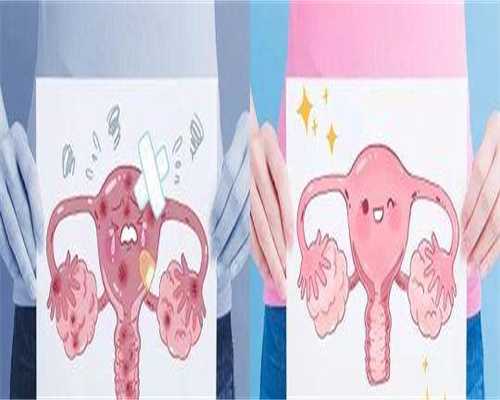 专业代生子：纵隔子宫对怀孕有影响吗？附医院排名一览！