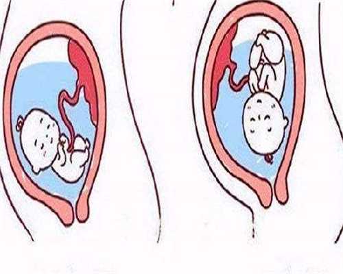 代怀孕网费用-4ac为几级囊胚，移植成功率高吗？