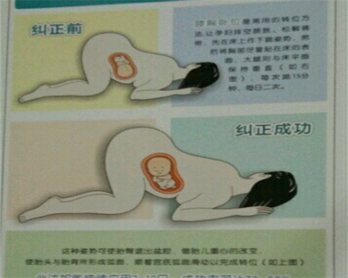 卵巢早衰试管适合什么方案？卵巢早衰试管成功案例？