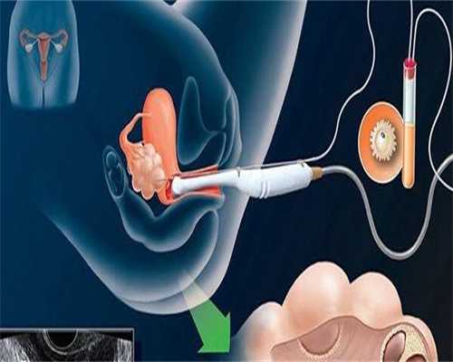 试管婴儿适用于什么妇女