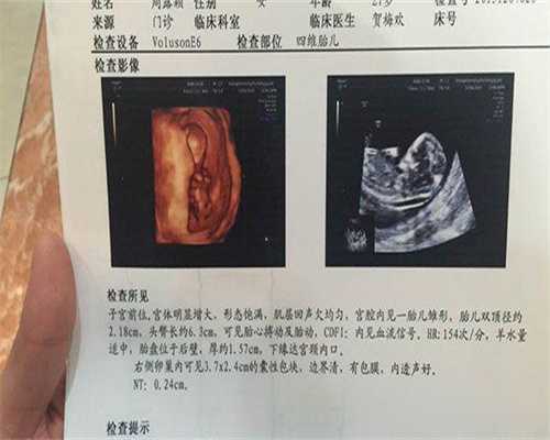 孕妇喝椰子汁有什么好处