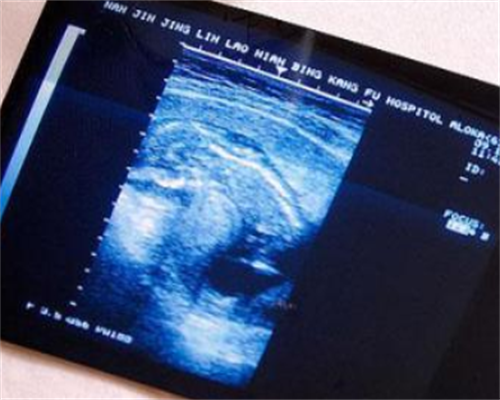 供卵包怀男孩-做腺肌症手术后一年做试管