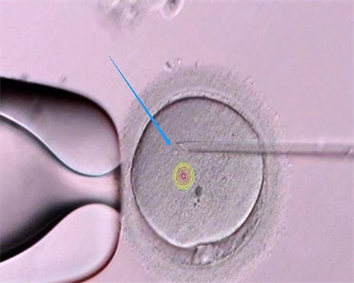 供卵增卵机构-促排卵期间能不能吃菠萝-打促排针期间可以吃菠萝蜜吗
