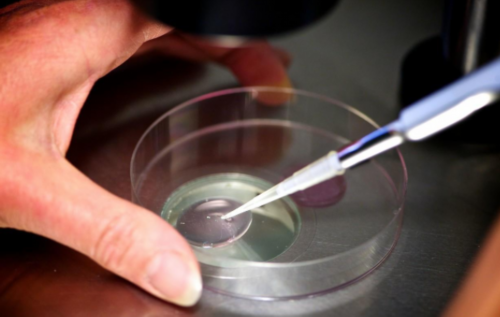 子宫畸形可以怀双胎吗