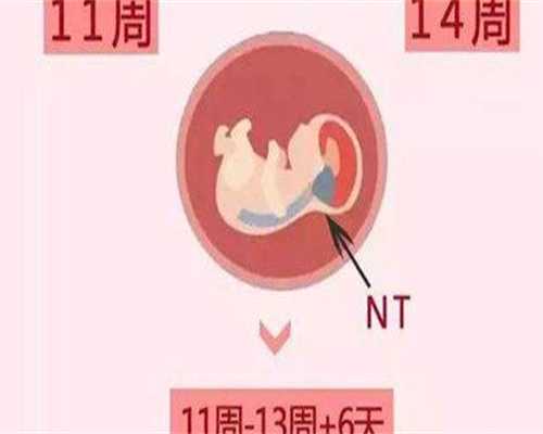 高龄女性能做试管婴儿吗