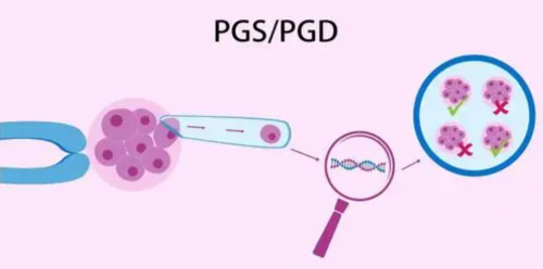 借卵自怀条件-屁股打针造成硬结怎样处理