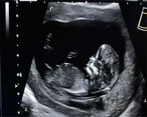 2026年最新江苏三代试管医院有哪些？附医院试管婴儿费用和成功率