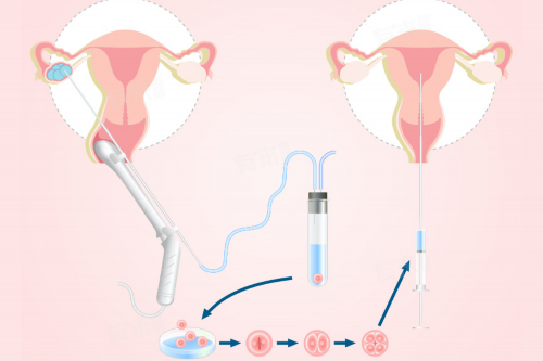 美中北三环院区能做三代试管吗？