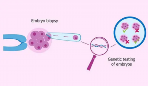 避孕环取不出来怎么办(避孕环的原理)