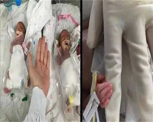 宫颈囊肿会影响试管着床吗?试管前如何治疗宫颈囊肿?