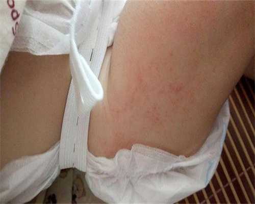 人工授精走自然周期吗,人工授精概率高还是自然怀孕