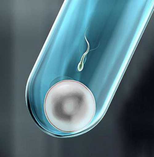 多囊怀孕后怎么保胎!多囊怀孕后保胎需要打肝素吗!