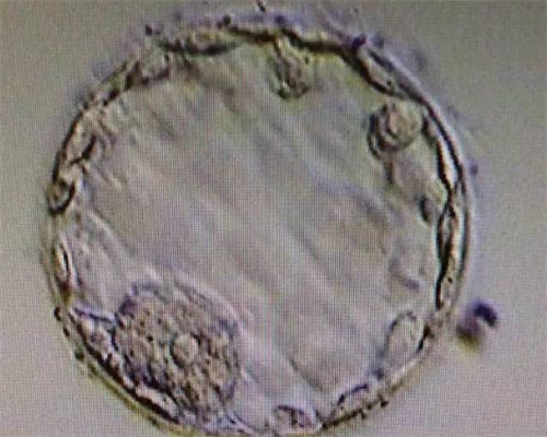 试管捐卵代怀-怀孕39天hcg正常值是多少