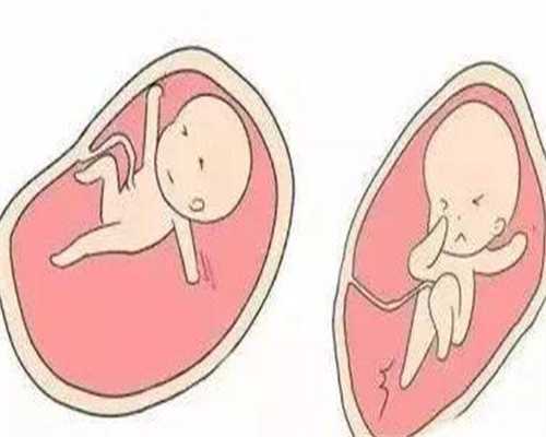 代怀孕花费:Q卵巢早衰是否还有卵泡