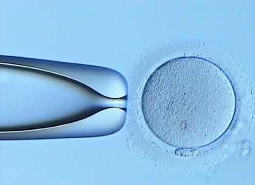 三代试管遗传疾病筛查能预防哪些遗传性疾病?鱼鳞病可以筛选吗?