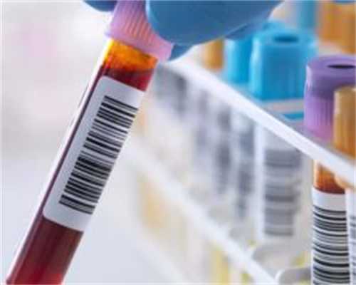 代生儿子电话-多囊卵巢自然怀孕,轻微多囊不吃药也能自然怀孕