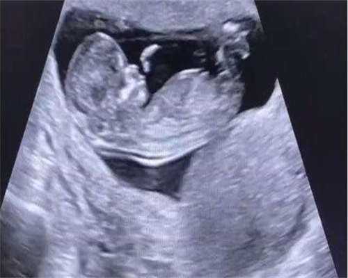 供卵代生网-左侧附件囊肿、泌乳素偏高想要二胎是否会影响怀孕？