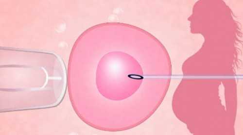 人工授精应该从哪天算怀孕?人工授精应该从哪天算怀孕天数?
