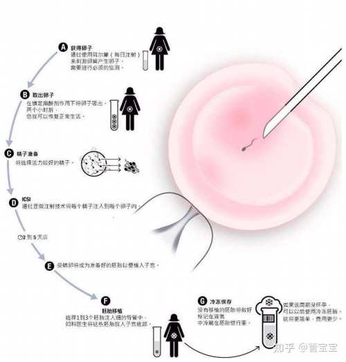 试管婴儿双胞胎过程，美国试管婴儿双胞胎过程