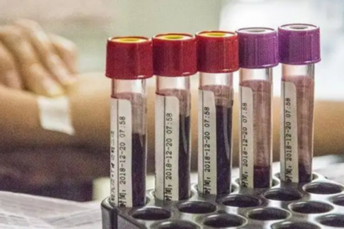 试管婴儿手术前该如何取卵