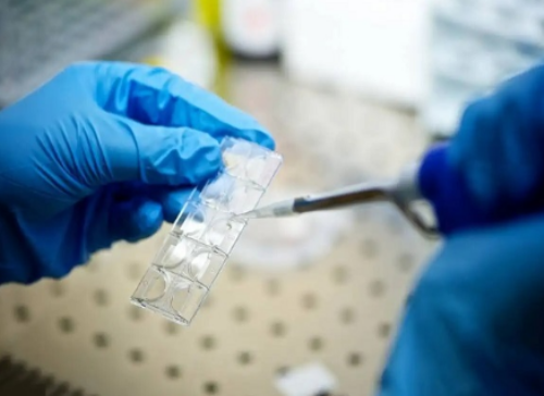 <strong>精子优化处理能不能分离XY精子？试管实验室怎么分离xy精子？</strong>