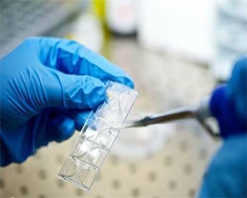 输卵管粘连的原因,输卵管粘连的症状