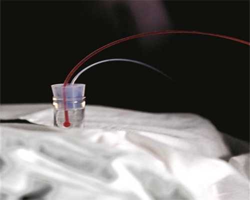 试管代怀套餐-系统B超主要检查什么