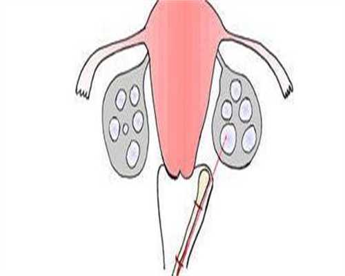 女人没卵泡是怎么回事-女人没卵泡是什么原因