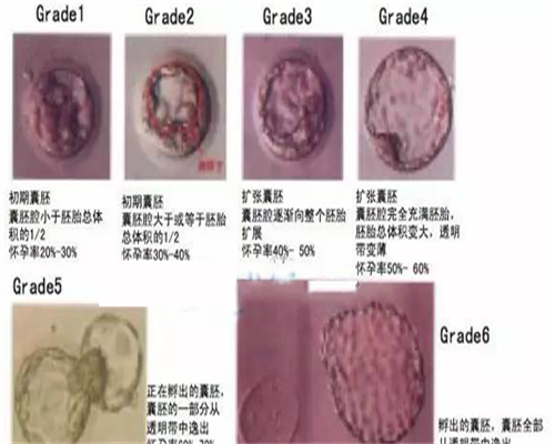 供卵试管代生-江苏省中医院试管婴儿怎么样